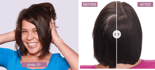 Keranique® results showing fuller-looking hair