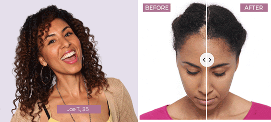 Keranique® results showing stronger healthier-looking hair